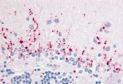 WNT2B Antibody in Immunohistochemistry (Paraffin) (IHC (P))