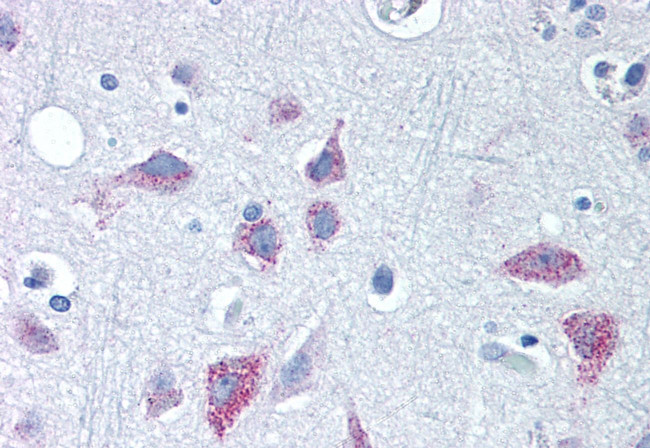 WNT8B Antibody in Immunohistochemistry (Paraffin) (IHC (P))