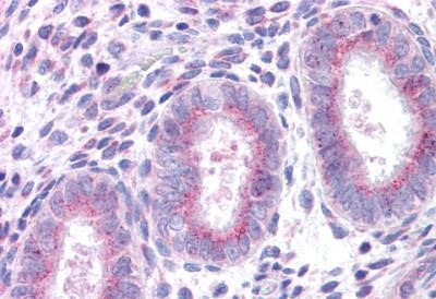 XCR1 Antibody in Immunohistochemistry (Paraffin) (IHC (P))