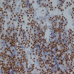 ENO1 Antibody in Immunocytochemistry (ICC/IF)