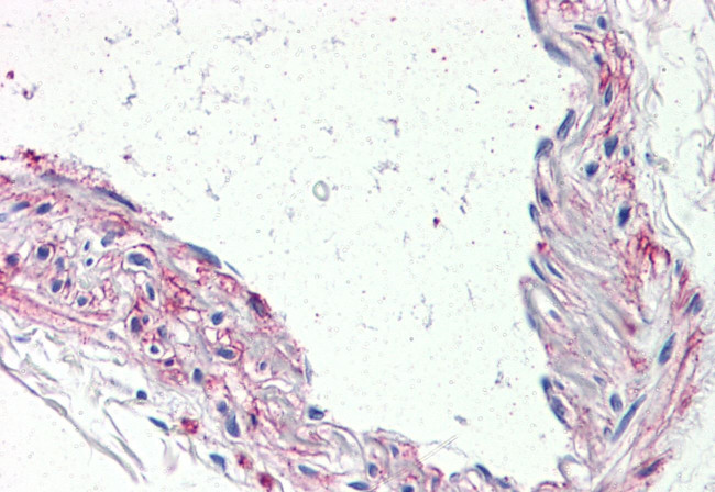 HTR1B Antibody in Immunohistochemistry (Paraffin) (IHC (P))