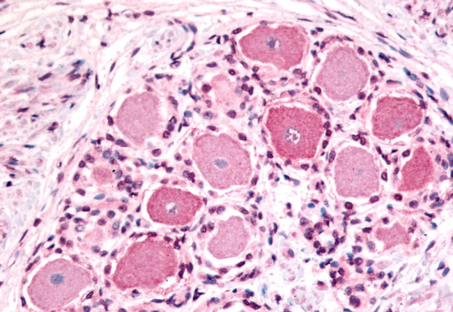 HTR1D Antibody in Immunohistochemistry (Paraffin) (IHC (P))