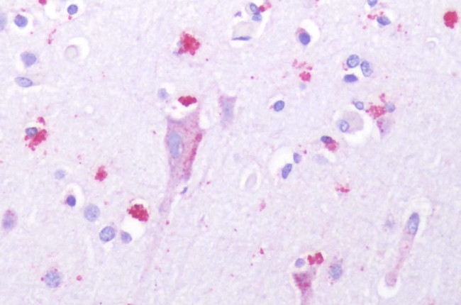 HTR1D Antibody in Immunohistochemistry (Paraffin) (IHC (P))