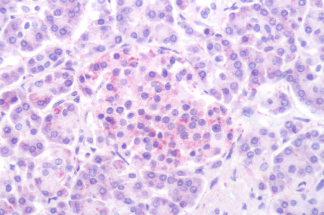 HTR1D Antibody in Immunohistochemistry (Paraffin) (IHC (P))