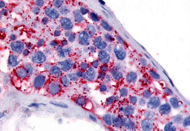 HTR1E Antibody in Immunohistochemistry (Paraffin) (IHC (P))