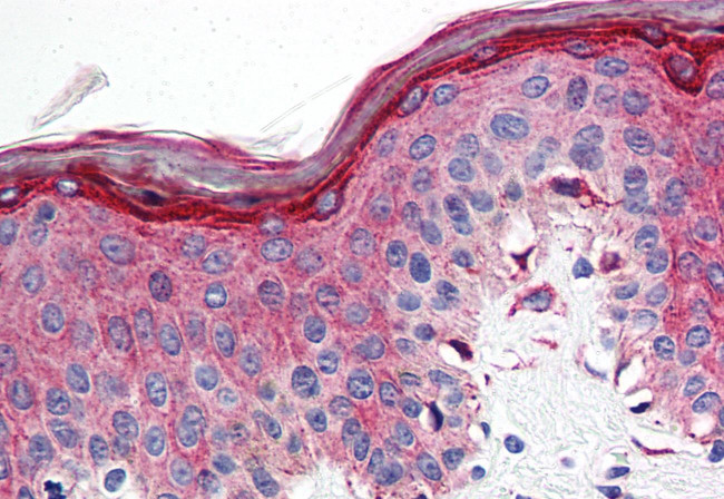 HTR1E Antibody in Immunohistochemistry (Paraffin) (IHC (P))