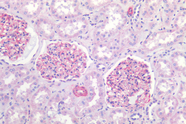 HTR1E Antibody in Immunohistochemistry (Paraffin) (IHC (P))