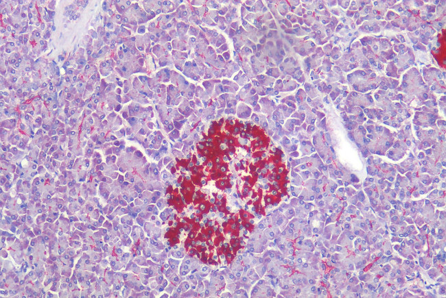 HTR1E Antibody in Immunohistochemistry (Paraffin) (IHC (P))