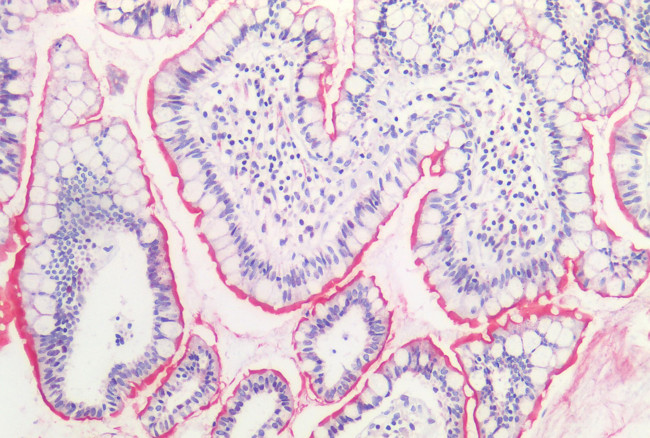 HTR1E Antibody in Immunohistochemistry (Paraffin) (IHC (P))