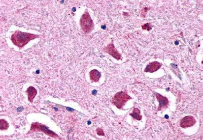 HTR2B Antibody in Immunohistochemistry (Paraffin) (IHC (P))