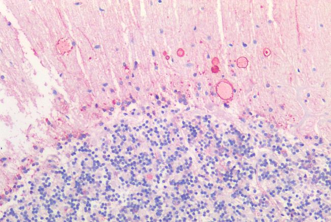 HTR2C Antibody in Immunohistochemistry (Paraffin) (IHC (P))