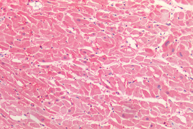 HTR2C Antibody in Immunohistochemistry (Paraffin) (IHC (P))