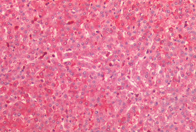 HTR2C Antibody in Immunohistochemistry (Paraffin) (IHC (P))