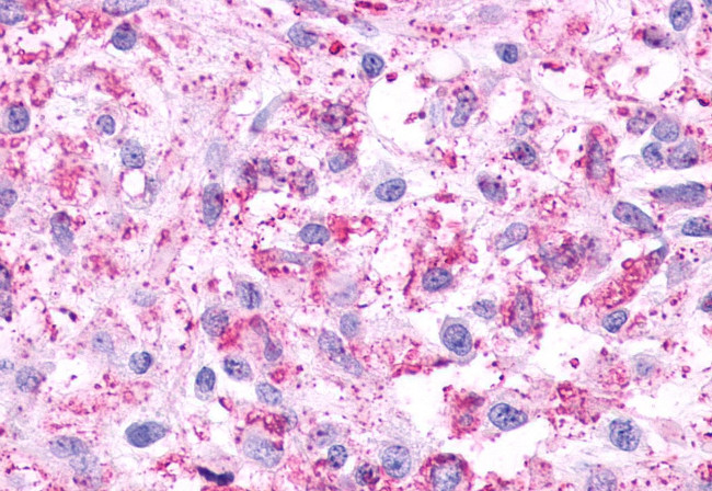 HTR4 Antibody in Immunohistochemistry (Paraffin) (IHC (P))