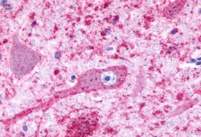 HTR4 Antibody in Immunohistochemistry (Paraffin) (IHC (P))