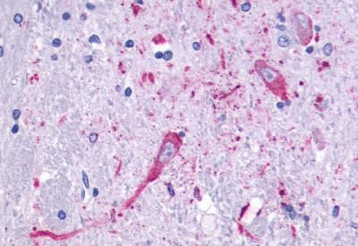 HTR4 Antibody in Immunohistochemistry (Paraffin) (IHC (P))