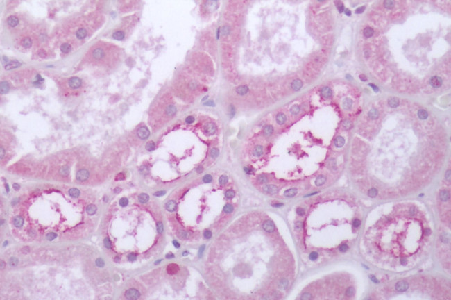 HTR4 Antibody in Immunohistochemistry (Paraffin) (IHC (P))