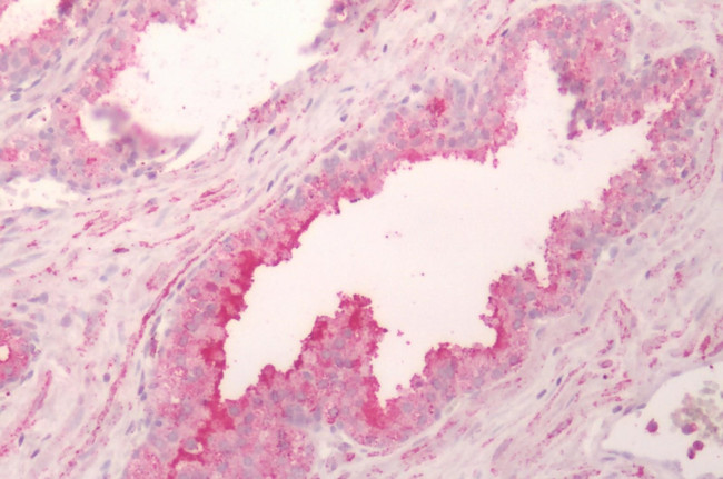 HTR4 Antibody in Immunohistochemistry (Paraffin) (IHC (P))