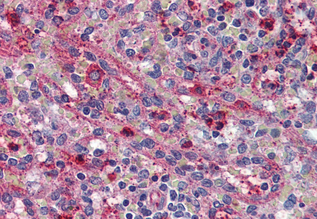 ACVR1C Antibody in Immunohistochemistry (Paraffin) (IHC (P))