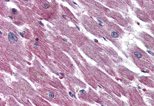 PACAP Receptor Antibody in Immunohistochemistry (Paraffin) (IHC (P))