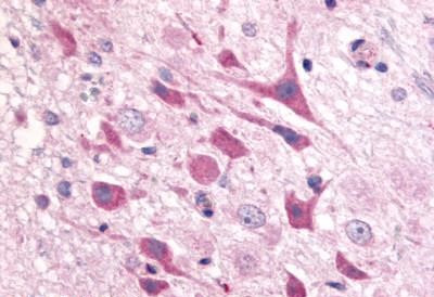 ADORA1 Antibody in Immunohistochemistry (Paraffin) (IHC (P))