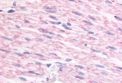 alpha-2c Adrenergic Receptor Antibody in Immunohistochemistry (Paraffin) (IHC (P))