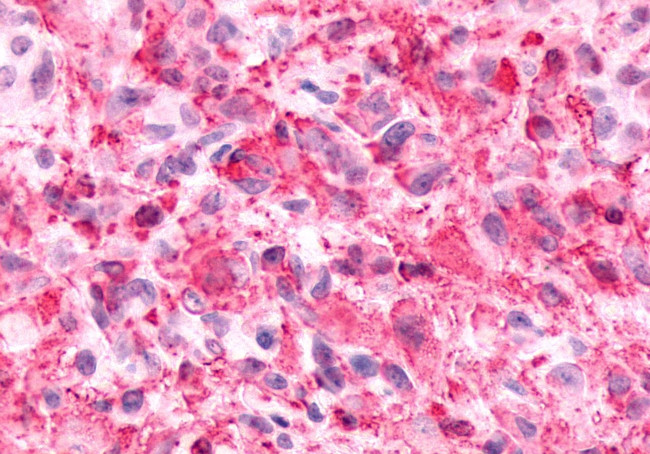 alpha-2c Adrenergic Receptor Antibody in Immunohistochemistry (Paraffin) (IHC (P))