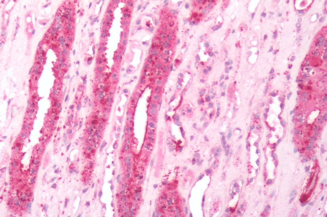 beta-3 Adrenergic Receptor Antibody in Immunohistochemistry (Paraffin) (IHC (P))