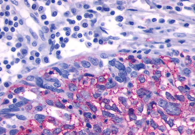 beta-3 Adrenergic Receptor Antibody in Immunohistochemistry (Paraffin) (IHC (P))