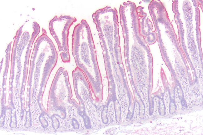 beta-3 Adrenergic Receptor Antibody in Immunohistochemistry (Paraffin) (IHC (P))