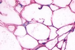 beta-3 Adrenergic Receptor Antibody in Immunohistochemistry (Paraffin) (IHC (P))