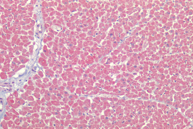 AGTR2 Antibody in Immunohistochemistry (Paraffin) (IHC (P))