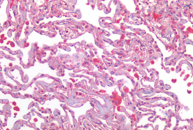 AGTR2 Antibody in Immunohistochemistry (Paraffin) (IHC (P))