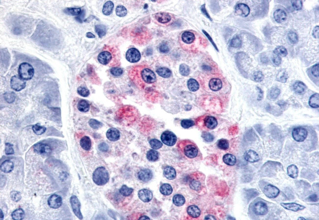 AVPR1B Antibody in Immunohistochemistry (Paraffin) (IHC (P))