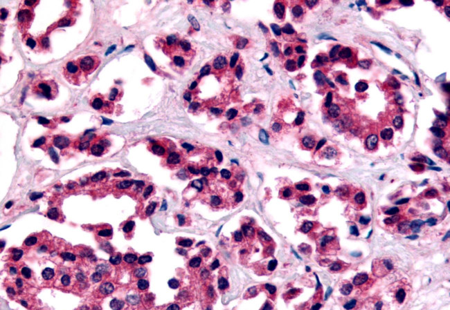 AVPR1B Antibody in Immunohistochemistry (Paraffin) (IHC (P))