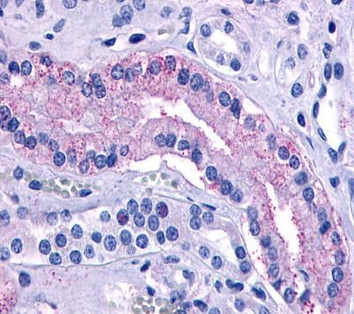 AVPR2 Antibody in Immunohistochemistry (Paraffin) (IHC (P))