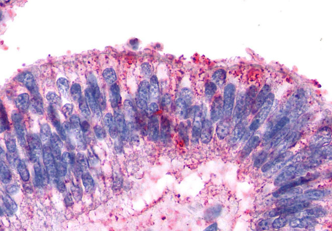 AVPR2 Antibody in Immunohistochemistry (Paraffin) (IHC (P))