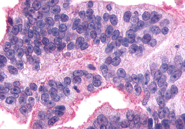 AVPR2 Antibody in Immunohistochemistry (Paraffin) (IHC (P))