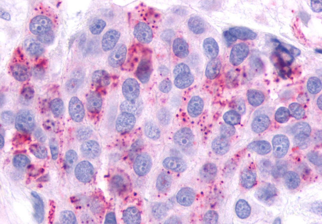 AVPR2 Antibody in Immunohistochemistry (Paraffin) (IHC (P))