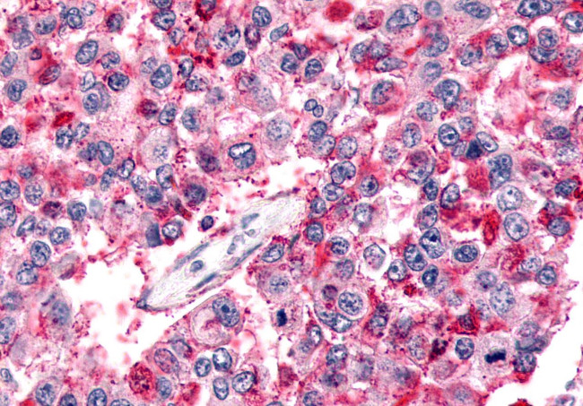 BAI2 Antibody in Immunohistochemistry (Paraffin) (IHC (P))