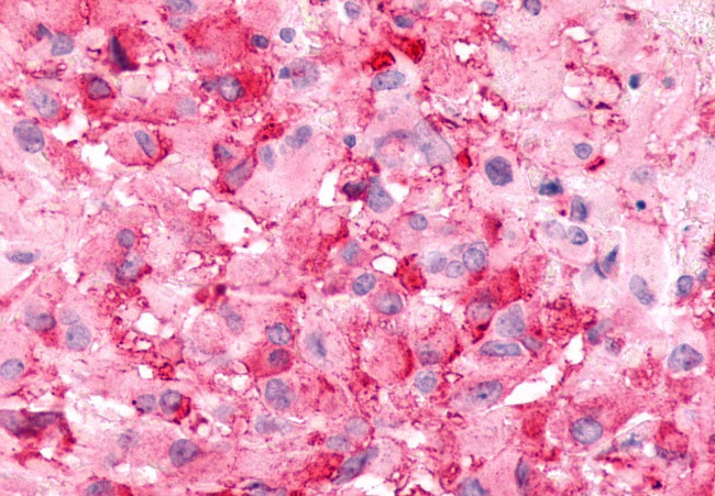 BAI2 Antibody in Immunohistochemistry (Paraffin) (IHC (P))