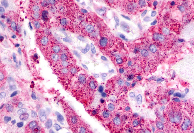 BAI3 Antibody in Immunohistochemistry (Paraffin) (IHC (P))