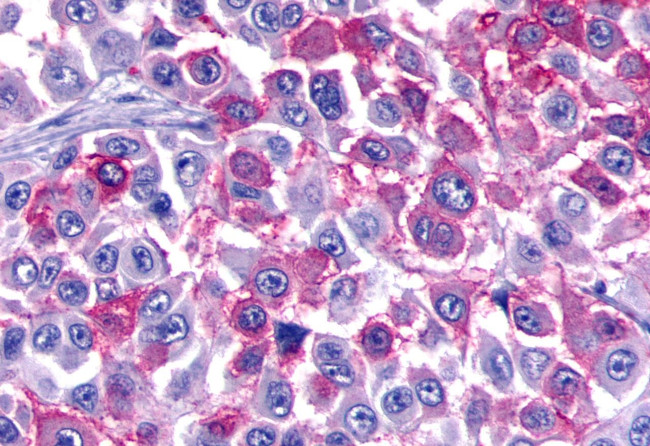 BAI3 Antibody in Immunohistochemistry (Paraffin) (IHC (P))