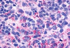 BAI3 Antibody in Immunohistochemistry (Paraffin) (IHC (P))