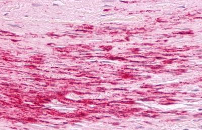 B1 Bradykinin Receptor Antibody in Immunohistochemistry (Paraffin) (IHC (P))