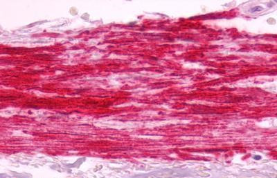 B1 Bradykinin Receptor Antibody in Immunohistochemistry (Paraffin) (IHC (P))