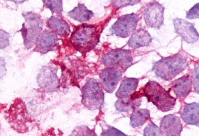 BDKRB2 Antibody in Immunocytochemistry (ICC/IF)