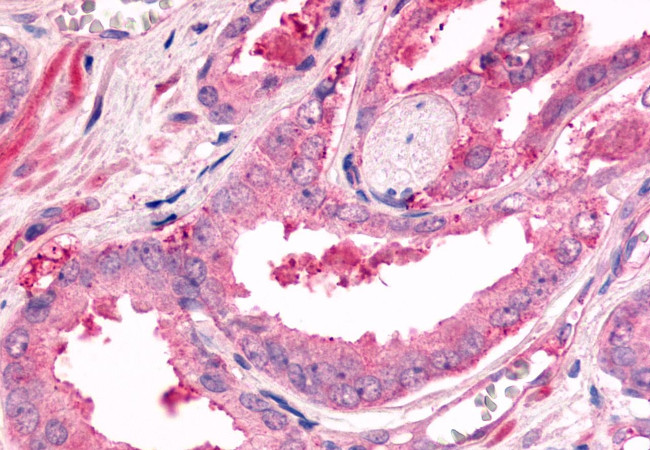 BDKRB2 Antibody in Immunohistochemistry (Paraffin) (IHC (P))