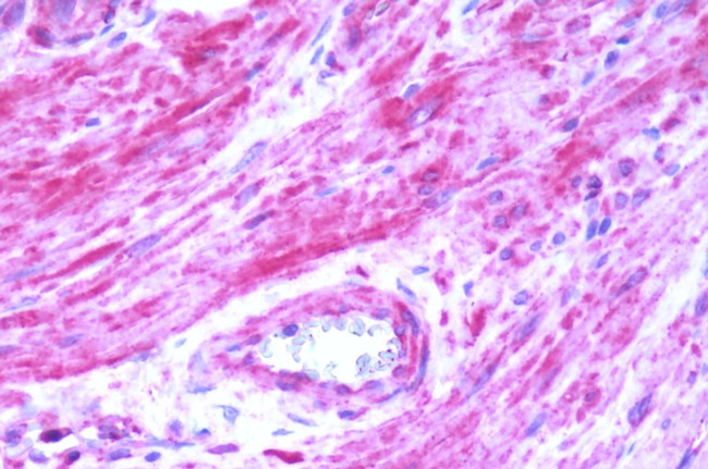 BDKRB2 Antibody in Immunohistochemistry (Paraffin) (IHC (P))