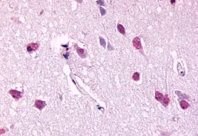 BDKRB2 Antibody in Immunohistochemistry (Paraffin) (IHC (P))